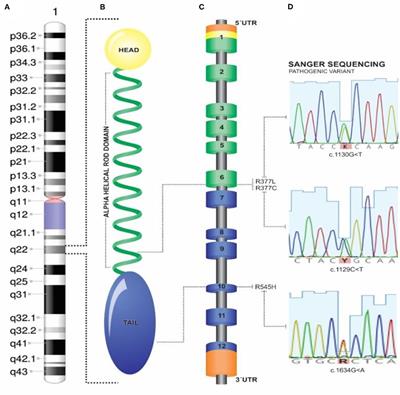 Effect of Occurrence of Lamin A/C (LMNA) Genetic Variants in a Cohort of 101 Consecutive Apparent “Lone AF” Patients: Results and Insights